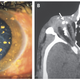Image: Parul C. Gupta, NEJM (2017)